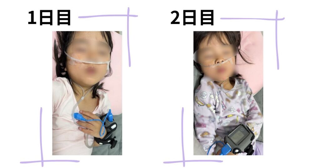 就寝中の酸素モニタリング検査|自宅で2晩測定