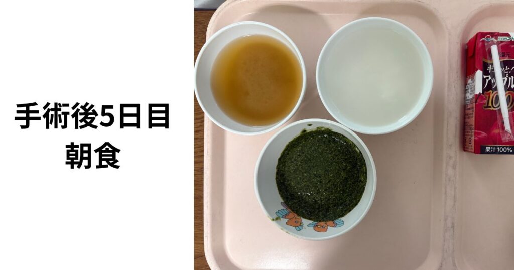 子ども用:扁桃腺手術後の食事は“見た目”と“食感”がカギ